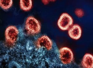 HIV on virus, joka hyökkää elimistön immuunijärjestelmää vastaan. Kuva: National Institute of Allergy and Infectious Diseases / Unsplash