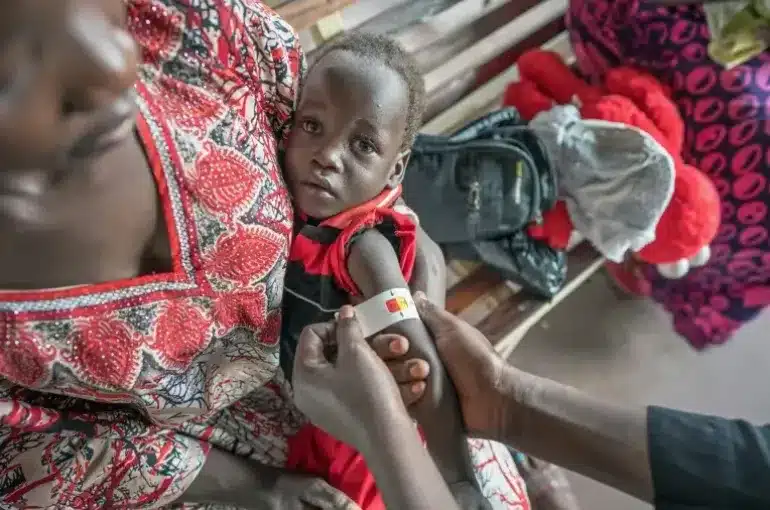 Barn rannsakað vegna vannæringar í Suður-Súdan. Mynd UNICEF/Naftalin